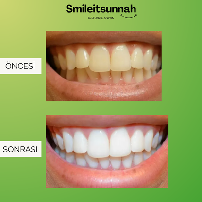 YENİ NESİL MİSVAK | FERAH NEFES FORMÜLÜ